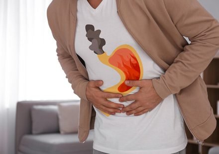 acidity & acid reflux